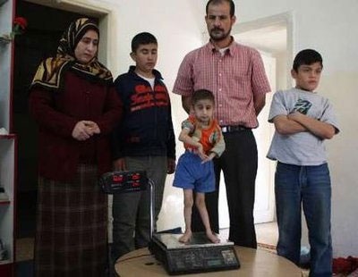 Chùm ảnh: Thăm cậu bé tí hon nhất thế giới - 8 Chùm ảnh: Thăm cậu bé tí hon nhất thế giới - 8