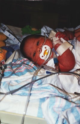 Gặp hai cô bé “người cá” ở Mỹ - 1 Gặp hai cô bé “người cá” ở Mỹ - 1