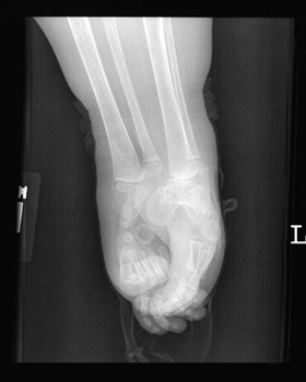 Gặp hai cô bé “người cá” ở Mỹ - 5 Gặp hai cô bé “người cá” ở Mỹ - 5