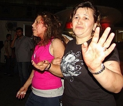 Chùm ảnh: Đánh bom khủng bố kép ở Istanbul - 2 Chùm ảnh: Đánh bom khủng bố kép ở Istanbul - 2