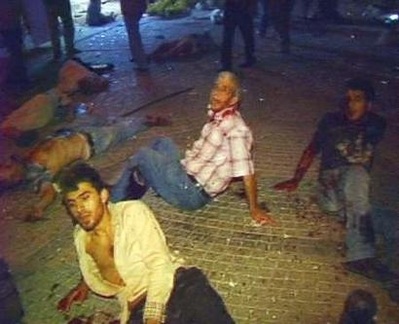 Chùm ảnh: Đánh bom khủng bố kép ở Istanbul - 4 Chùm ảnh: Đánh bom khủng bố kép ở Istanbul - 4