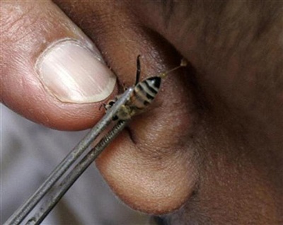 Chùm ảnh: Những kiểu chữa bệnh lạ đời - 8