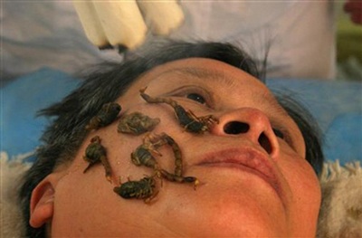 Chùm ảnh: Những kiểu chữa bệnh lạ đời - 12