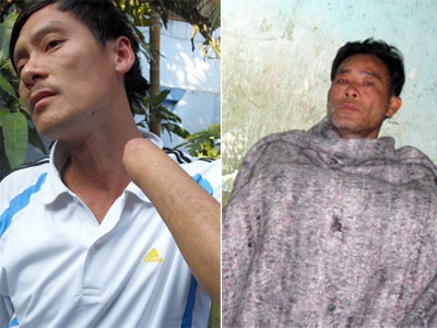 Xô xát phát gạo cứu đói, hai người bị thương               - 1