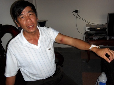 Chồng tưới cả nồi canh đang sôi lên người vợ  - 1