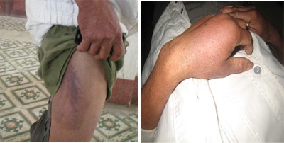 Công an phường đánh dân trọng thương? - 1