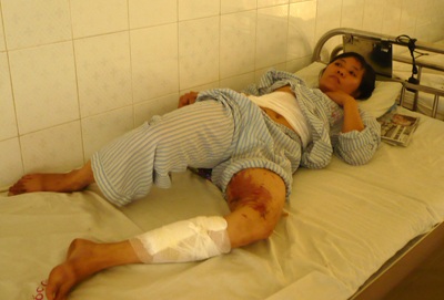 Chân dung kẻ tưới nồi canh đang sôi vào người vợ - 2