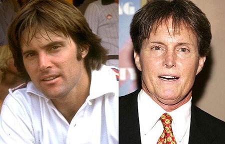 "Sốc" khi "sao" phẫu thuật thẩm mỹ - 10