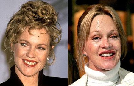 "Sốc" khi "sao" phẫu thuật thẩm mỹ - 11