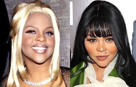 "Sốc" khi "sao" phẫu thuật thẩm mỹ - 13