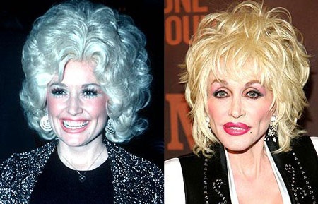 "Sốc" khi "sao" phẫu thuật thẩm mỹ - 14