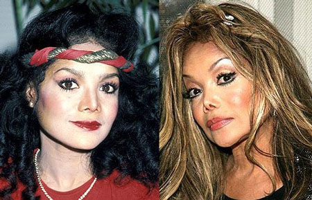 "Sốc" khi "sao" phẫu thuật thẩm mỹ - 16