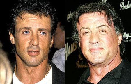 "Sốc" khi "sao" phẫu thuật thẩm mỹ - 21