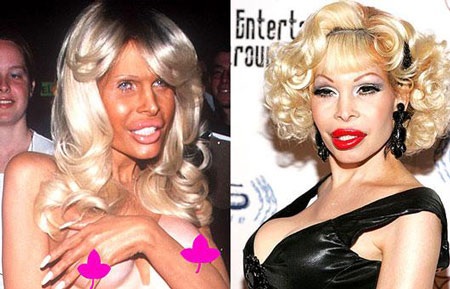 "Sốc" khi "sao" phẫu thuật thẩm mỹ - 6