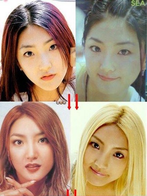 Người đẹp Hàn Quốc đẹp lên nhờ… dao kéo? - 11