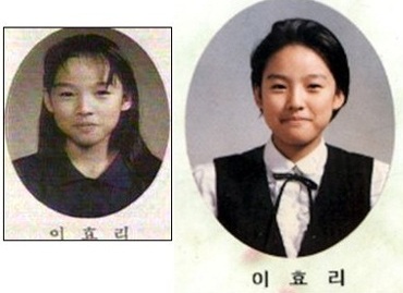 Lee Hyori từng phẫu thuật thẩm mỹ? - 3