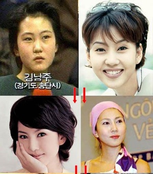 Người đẹp Hàn Quốc đẹp lên nhờ… dao kéo? - 9