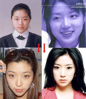 Người đẹp Hàn Quốc đẹp lên nhờ… dao kéo? - 13