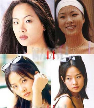 Người đẹp Hàn Quốc đẹp lên nhờ… dao kéo? - 3