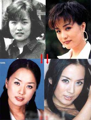 Người đẹp Hàn Quốc đẹp lên nhờ… dao kéo? - 1