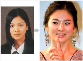 Vẻ đẹp của diễn viên Hàn Quốc: Thật hay giả? - 7