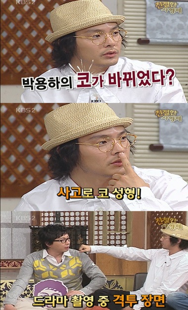 Diễn viên “Bản tình ca mùa đông” thừa nhận phẫu thuật mũi - 2