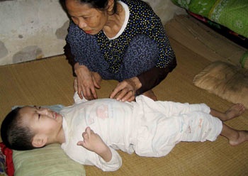 Một cháu bé bại não cần giúp đỡ - 1 Một cháu bé bại não cần giúp đỡ - 1