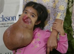 Bé Lài sắp được làm phẫu thuật tại Mỹ - 3