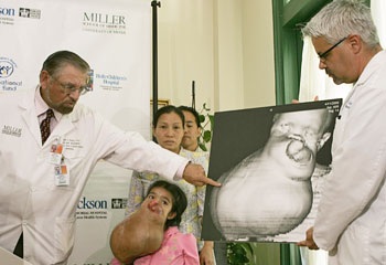 Bé Lài sắp được làm phẫu thuật tại Mỹ - 4