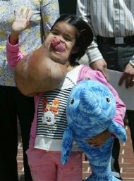 Bé Lài sắp được làm phẫu thuật tại Mỹ - 5