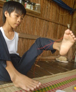 Đôi chân độc đáo của cậu bé không tay - 1 Đôi chân độc đáo của cậu bé không tay - 1