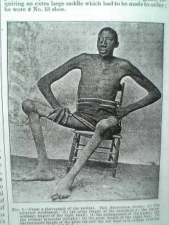 10 người đàn ông cao nhất thế giới - 11