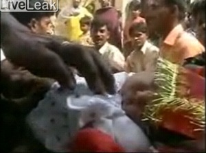 Em bé 2 mặt gây xôn xao Ấn Độ - 3