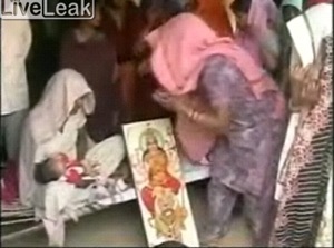 Em bé 2 mặt gây xôn xao Ấn Độ - 5