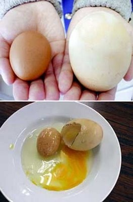 Lại một trường hợp trứng trong trứng - 1