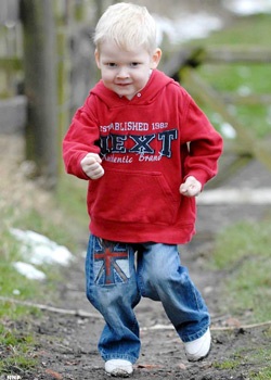 Bé trai có máu chảy ngược - 2