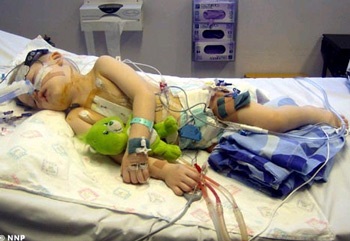 Bé trai có máu chảy ngược - 1