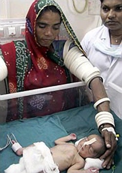 Bé sơ sinh thoát chết sau khi bị đẻ rơi xuống toa lét - 2