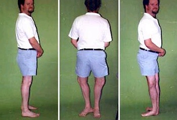 Người đàn ông có đôi chân 180 độ - 1 Người đàn ông có đôi chân 180 độ - 1