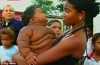 11 tháng tuổi nặng 28kg - 1