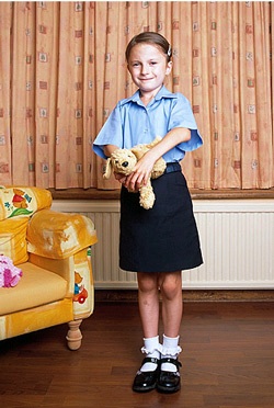 Bé gái "người hoá gỗ" - 2 Bé gái "người hoá gỗ" - 2