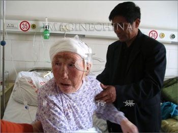 Cụ bà mang viên đạn trong đầu từ Thế chiến thứ 2 - 2