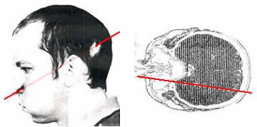 10 trường hợp thoát chết hy hữu (1) - 4 10 trường hợp thoát chết hy hữu (1) - 4