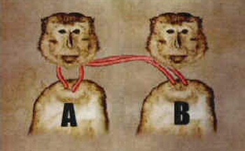 Lạ hơn tiểu thuyết: Ca ghép đầu đầu tiên của thế giới - 2 Lạ hơn tiểu thuyết: Ca ghép đầu đầu tiên của thế giới - 2