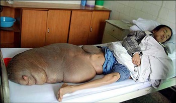 Người đàn ông có chiếc chân nặng 70kg - 1 Người đàn ông có chiếc chân nặng 70kg - 1