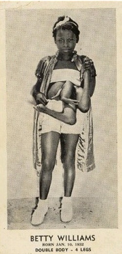 Người 4 chân, 3 tay - 2