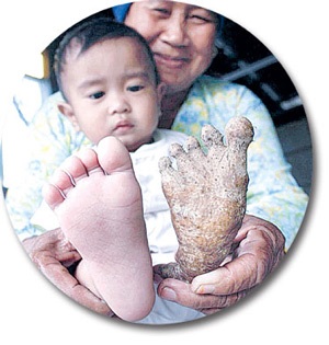 Củ sắn giống chân người - 2 Củ sắn giống chân người - 2