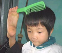 Bàn chân trái diệu kỳ - 1