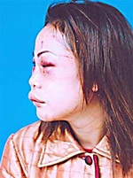 Bắt kẻ tra tấn người yêu sau 2 năm lẩn trốn - 1