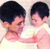 Nối thành công cánh tay bị đứt rời của cháu bé 18 tháng tuổi  - 1